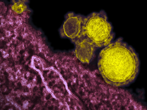 "Novel Coronavirus Particles - MERS-CoV" by AJC1 is licensed under CC BY-SA 2.0