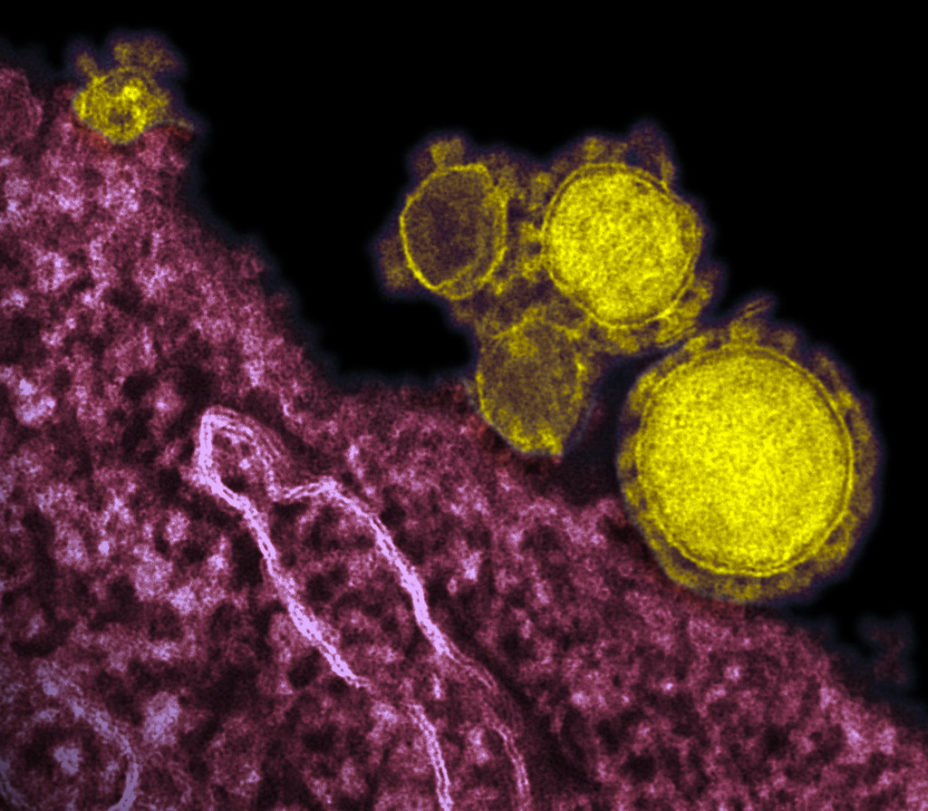 "Novel Coronavirus Particles - MERS-CoV" by AJC1 is licensed under CC BY-SA 2.0